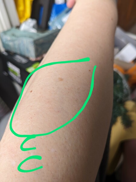 Tiny red spots on arms