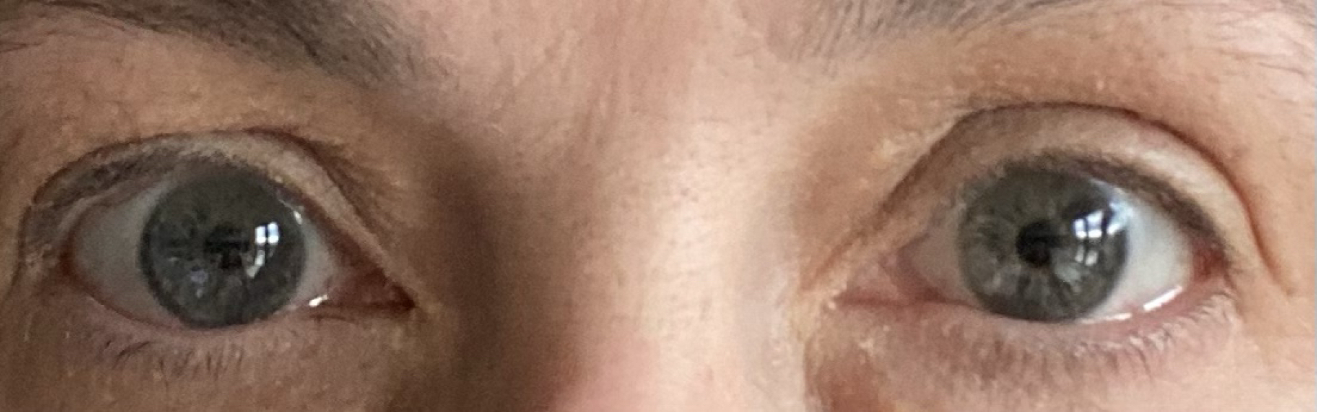 I'm 40 and I don't know what colour my eyes are! Photos