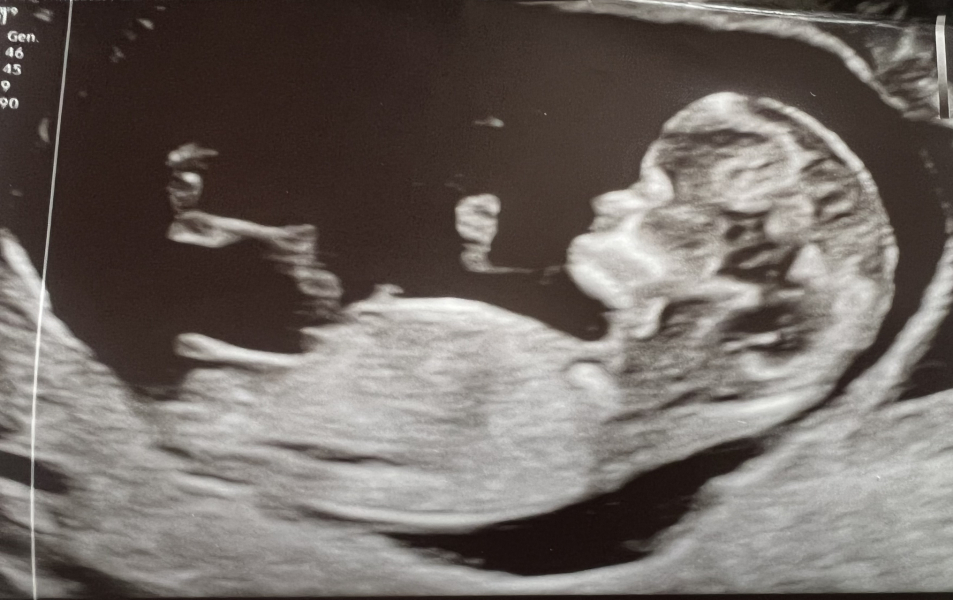 Second trimester and beyond! - Sept 23 