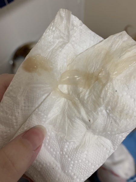 Period 6 weeks postpartum 