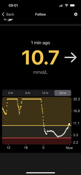 I’m type 1 diabetic AMA 