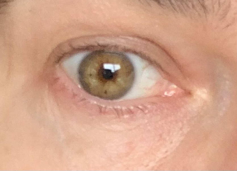 I'm 40 and I don't know what colour my eyes are! Photos