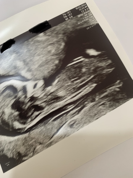 Second trimester and beyond! - Sept 23 