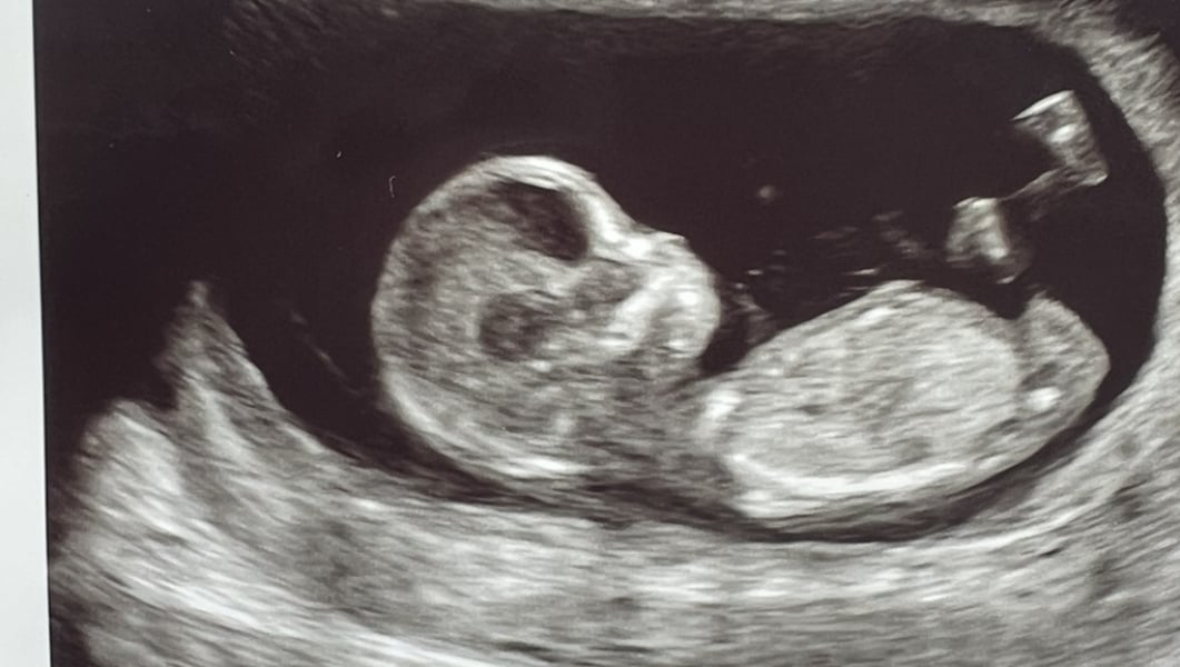 Girl or boy ?