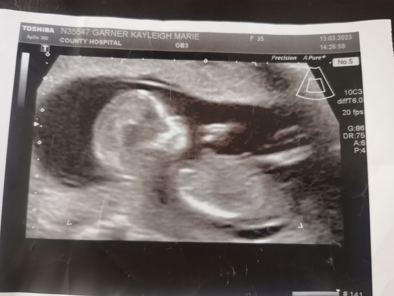 Is it a boy or girl?