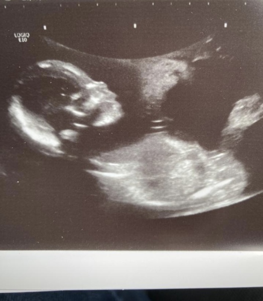 August Due Date Crew - Trimester 2 (Thread 7)