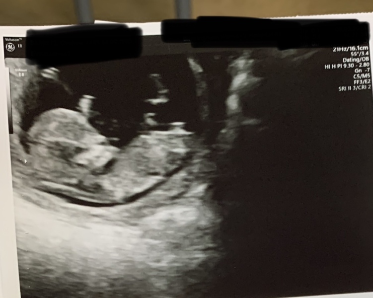Gender guesses? 💗💙👶🏼
