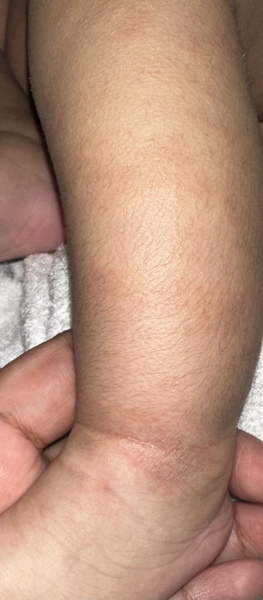 Really roughy and dry baby skin!!