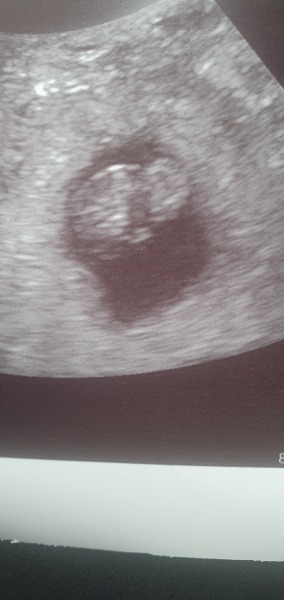 Due October 2023 - thread 3