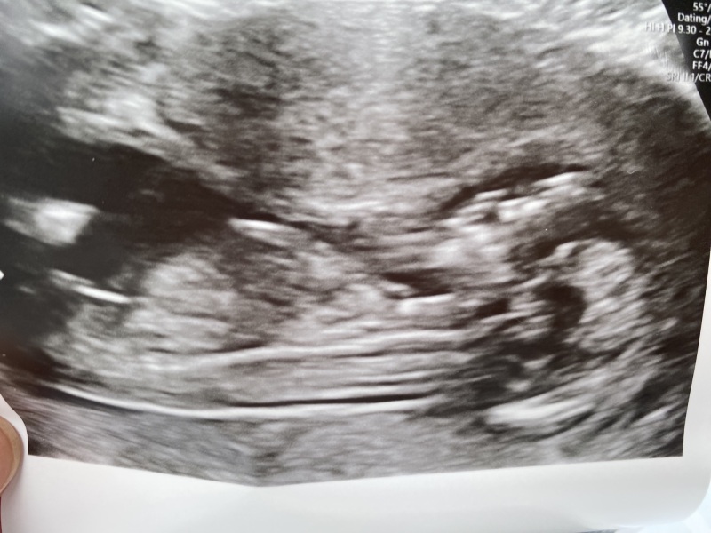 Due September 2023 after miscarriage 🌈