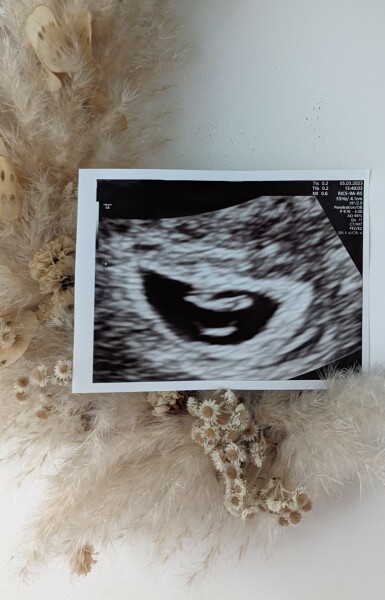 Due October 2023 - thread 3
