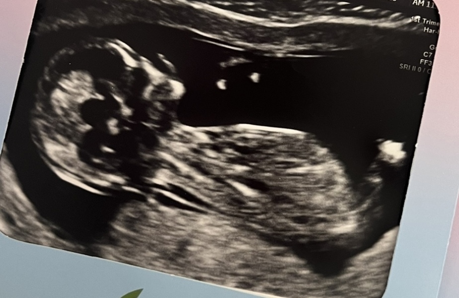 Nub theory! 12 weeks 4 days