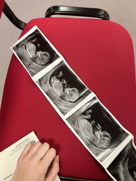 Due October 2023 - thread 4