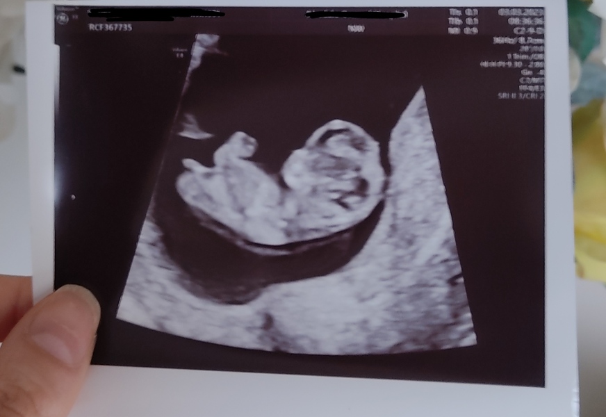 Second trimester and beyond! - Sept 23 