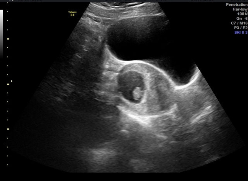 Due October 2023 - thread 4