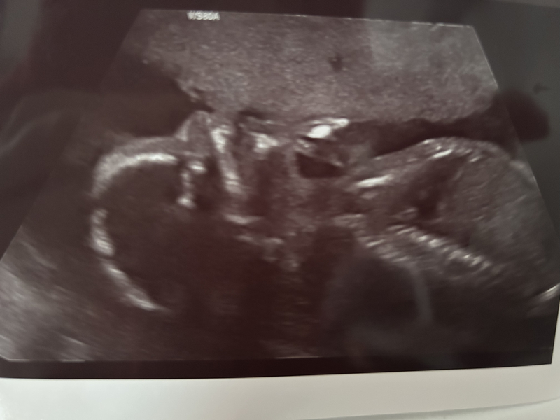 August Due Date Crew - Trimester 2 (Thread 7)