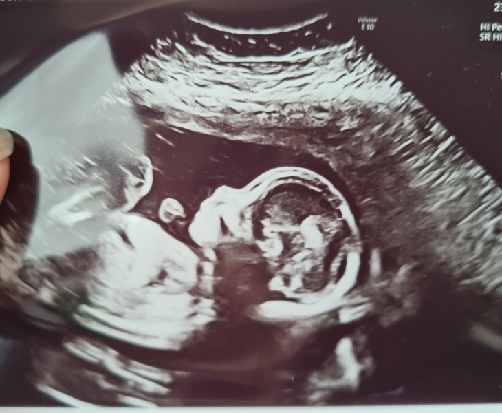 Gender prediction 13+2