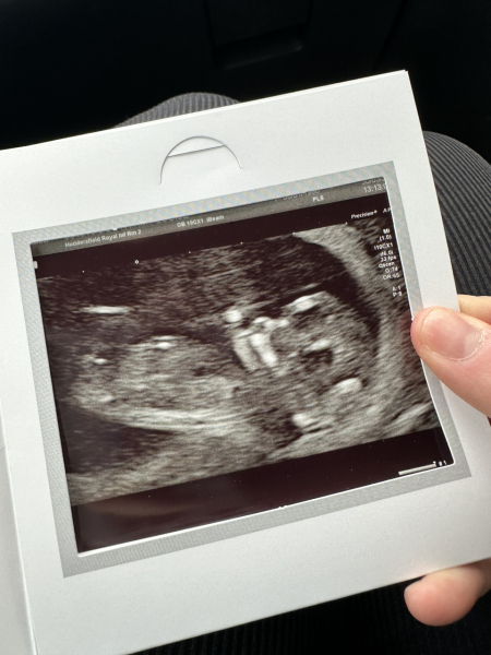 Due October 2023 - thread 4