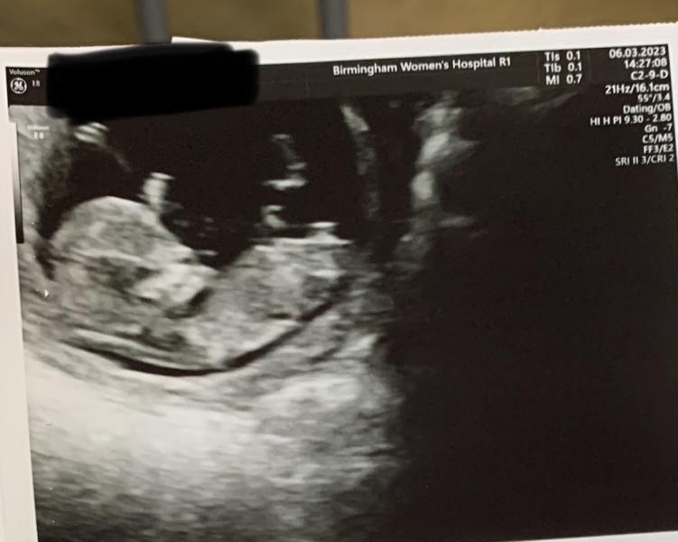 Due September 2023 after miscarriage 🌈