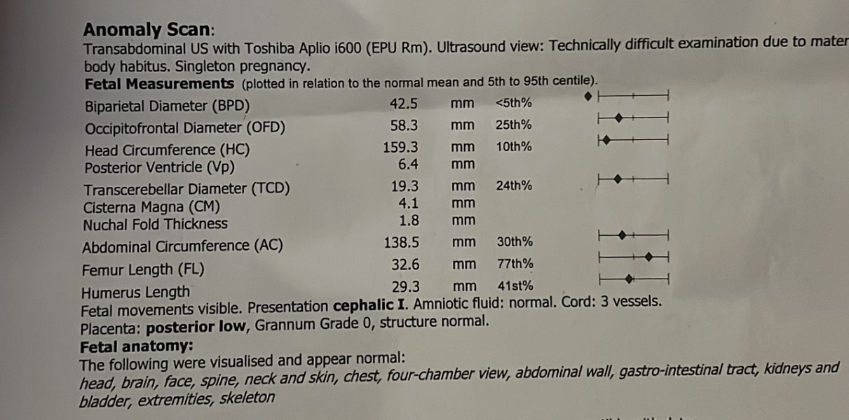 Baby head measuring <5% percentile - off the chart