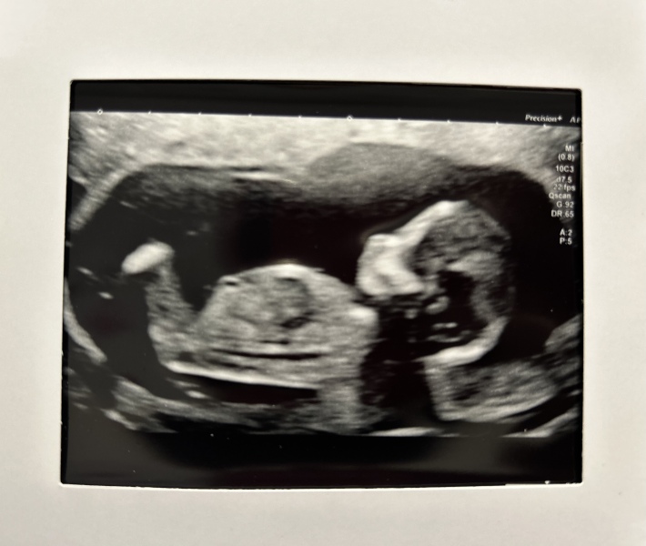 End Aug/Early Sept Due Date (Thread 2)