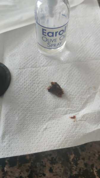 The best thing your body has produced *warning-grim content not suitable for weak-stomached persons*