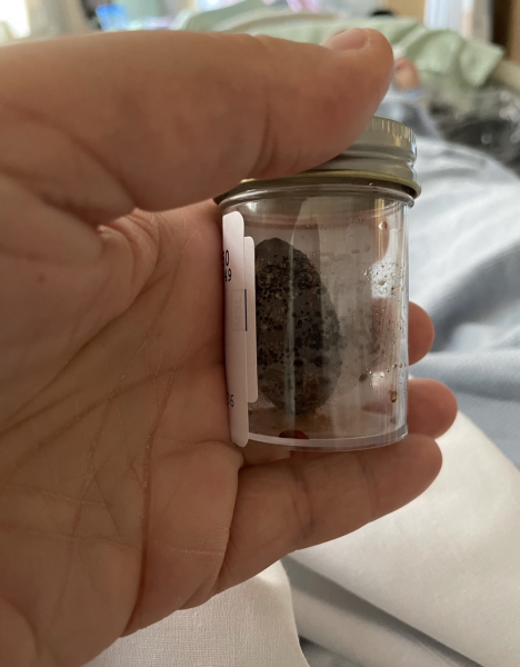 gallbladder agony