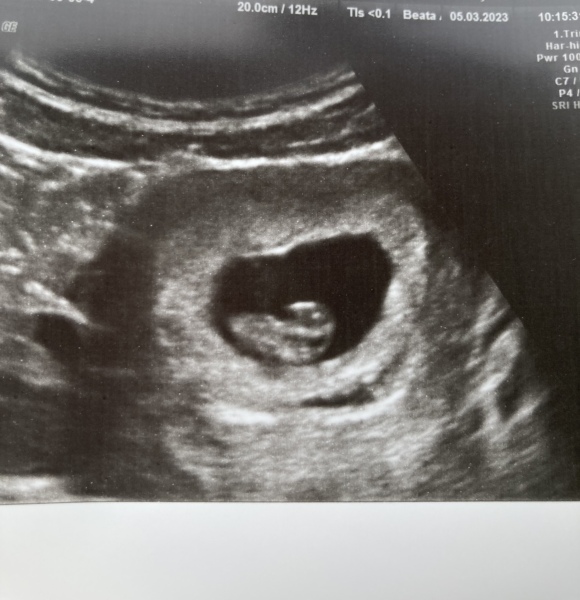 Due October 2023 - thread 3