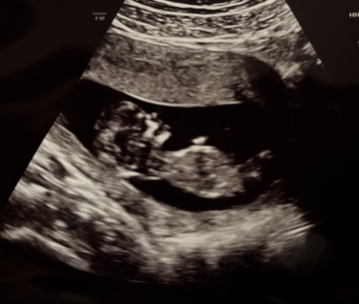 End Aug/Early Sept Due Date (Thread 2)