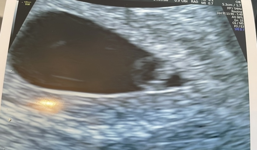 Due October 2023 - thread 3