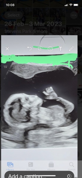 Gender guess please 