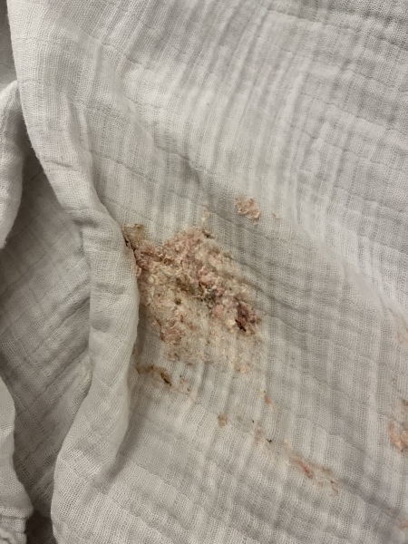 URGENT - Newborn throwing up blood?? 