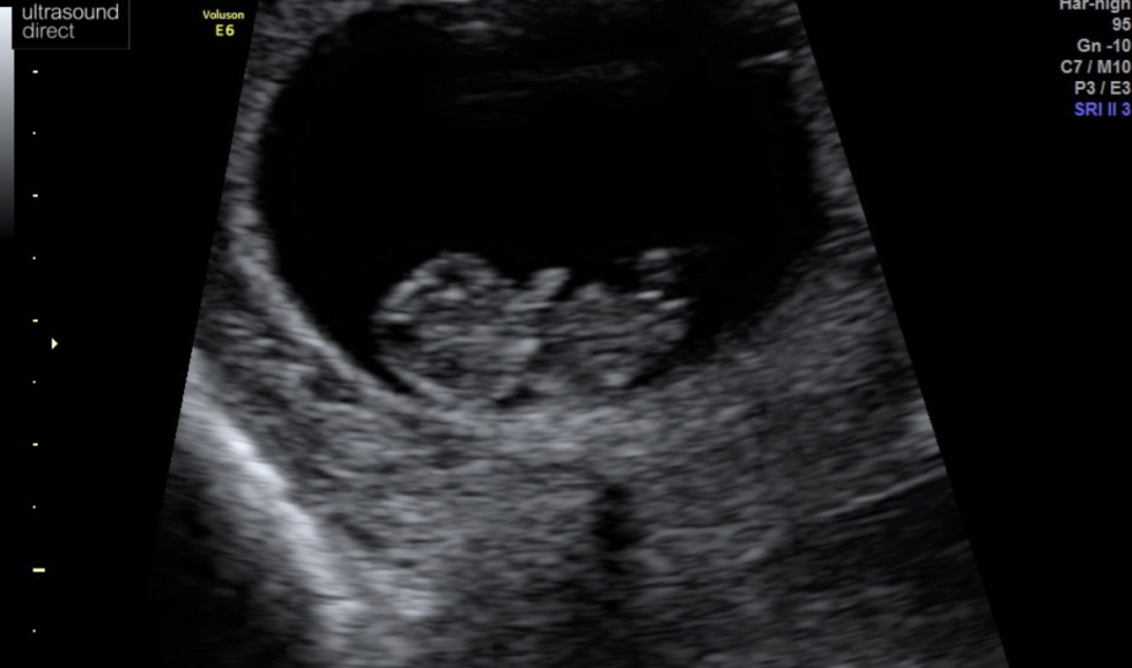 Due October 2023 - thread 4
