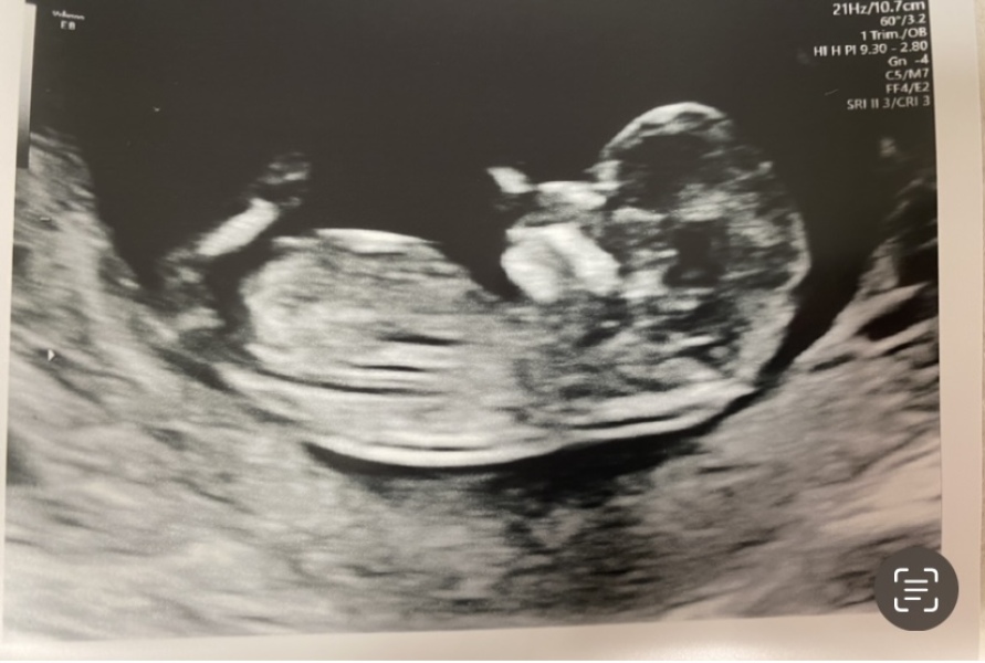Due September 2023 after miscarriage 🌈
