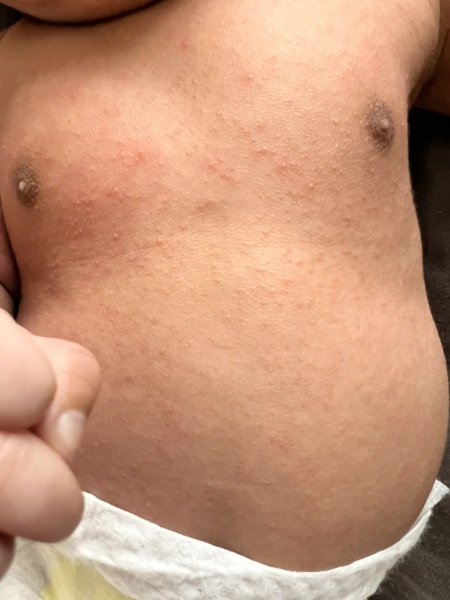Is this something to be concerned about? Pic included