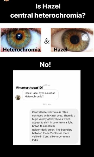 I'm 40 and I don't know what colour my eyes are! Photos