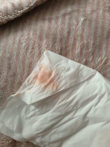 *GRAPHIC IMAGE* Implantation bleeding?