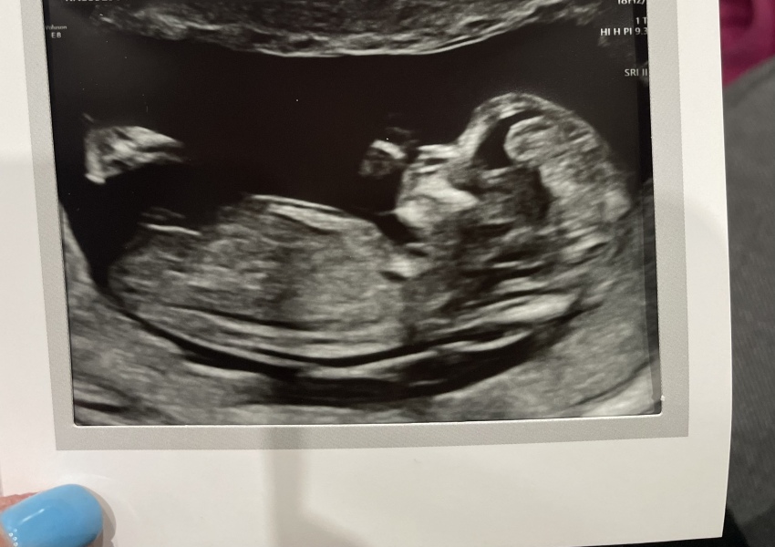 12 weeks scan any guesses
