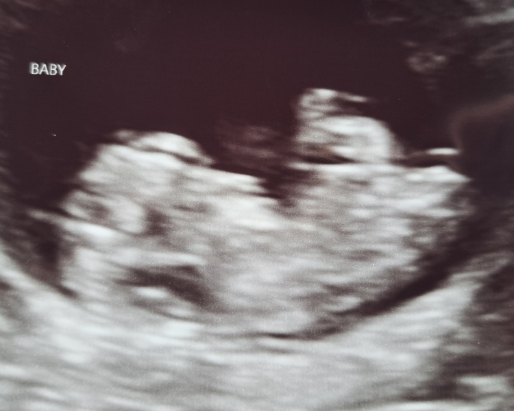 Due October 2023 - thread 4