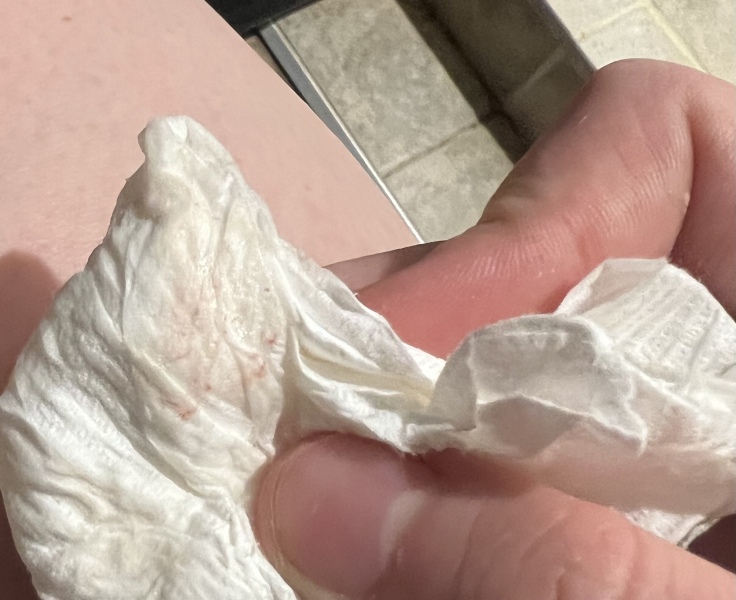 Implantation bleeding?