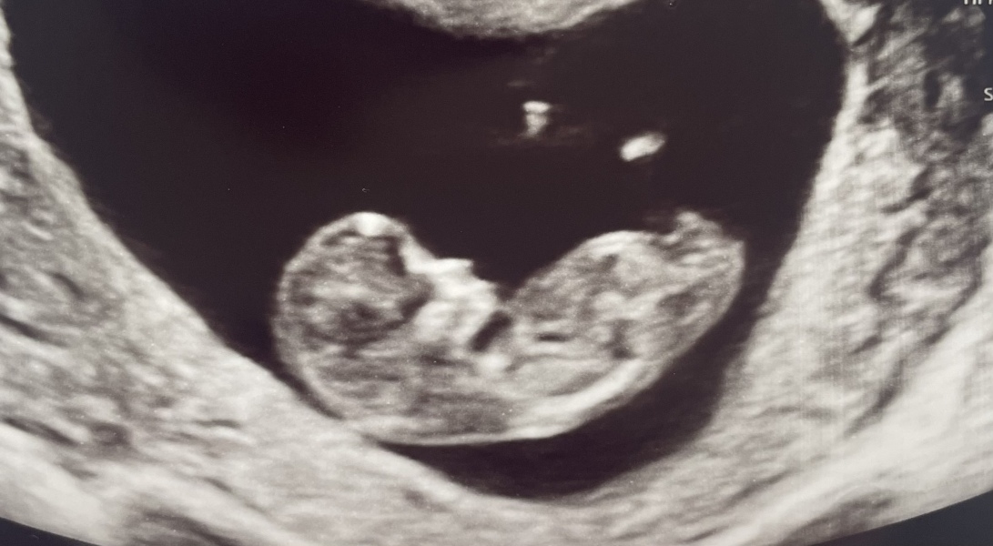 Due October 2023 - thread 4
