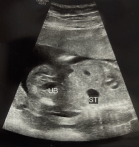 Due end of Aug/Sept babies 🤞🏻