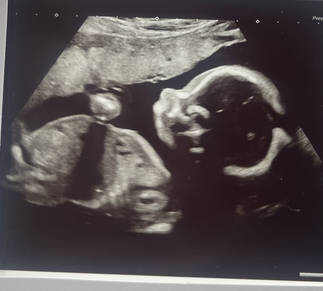 August Due Date Crew - Trimester 2 (Thread 7)