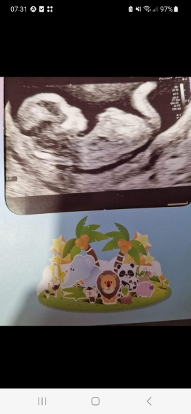 Gender guesses