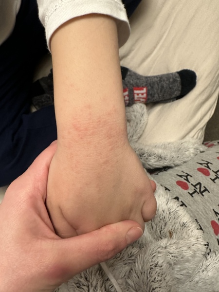 What is this rash?!