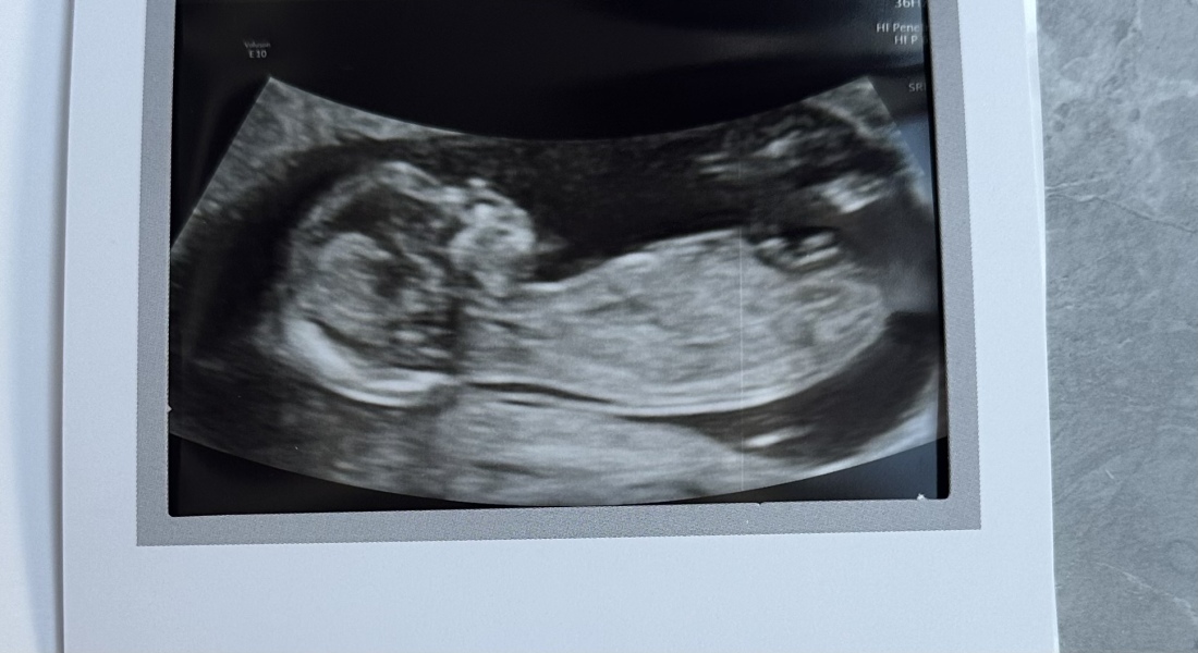 Due September 2023 after miscarriage 🌈
