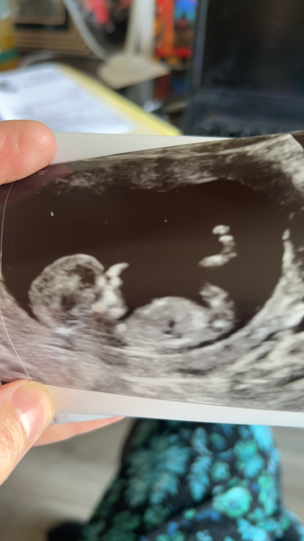 Due October 2023 - thread 4
