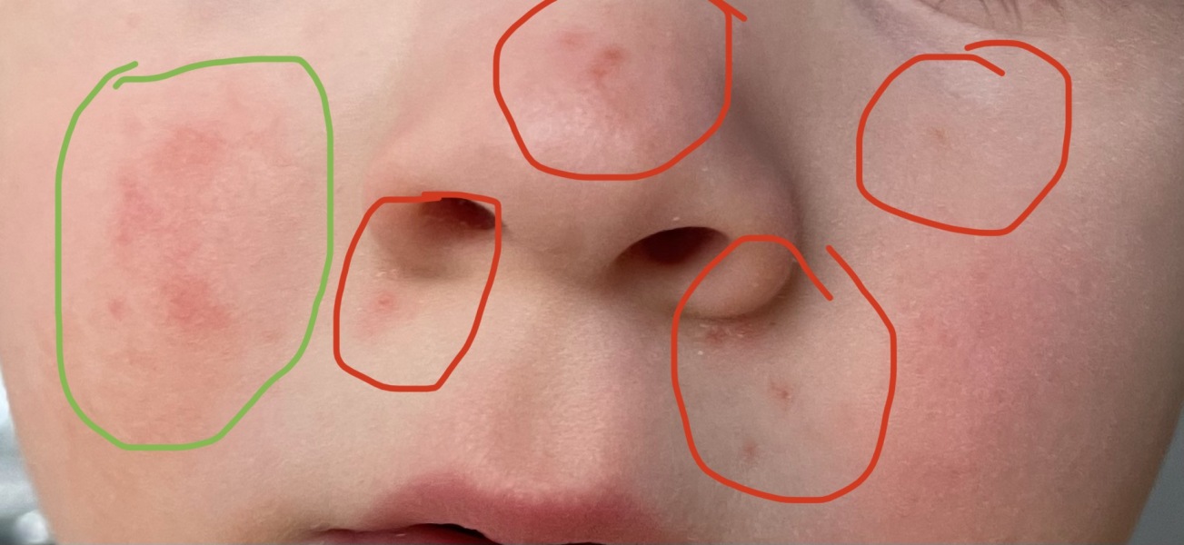 Tiny spots and now sore eyes?