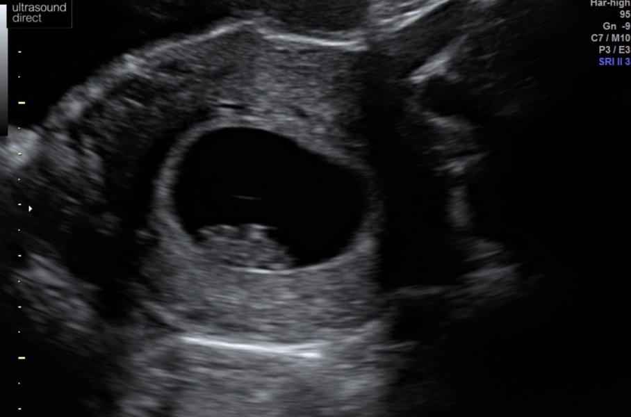 Due October 2023 - thread 3