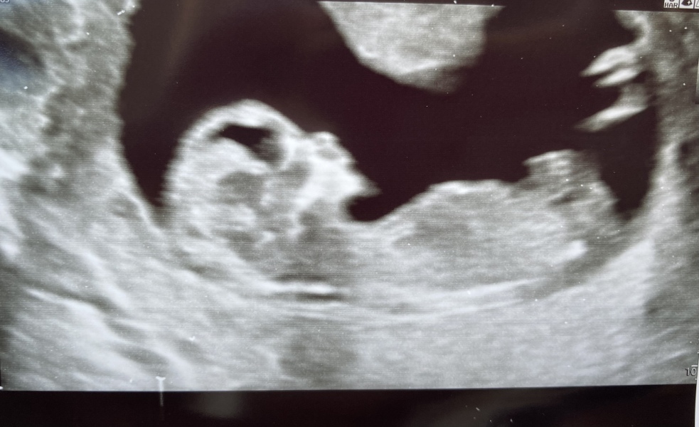 Nub guesses? 12w 5d